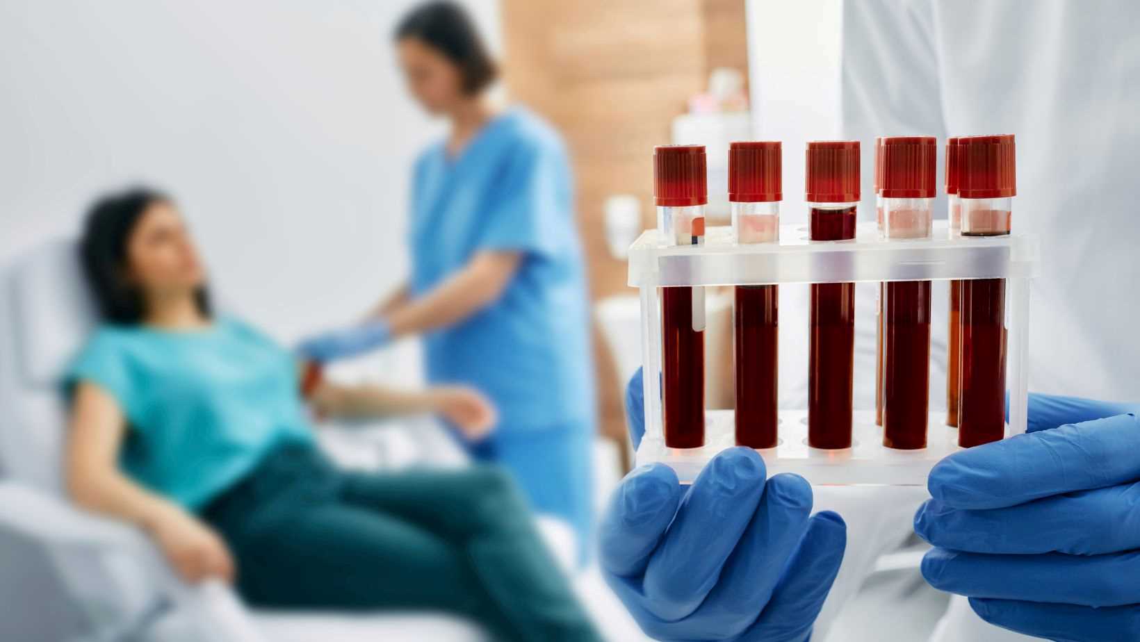 laboratory blood tests Laboratory Preventica Sofia